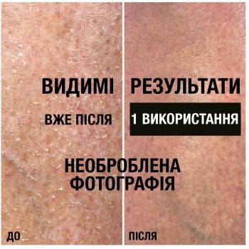 Лосьйон для тіла Neutrogena Інтенсивне  відновлення 250 мл (3574661751603) | Фото 8