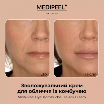 Зволожувальний ампульний крем MEDI-PEEL Hyal Kombucha Tea-tox cream 50 мл (8809409346489) | Фото 4