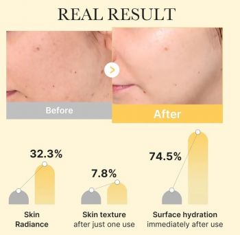 Маска гідрогелева Medicube Kojic Acid Turmeric освітлювальна 28 г (8800256114658) | Фото 4