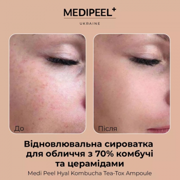 Відновлююча сироватка MEDI-PEEL Hyal Kombucha Tea-Tox Ampoule 50 мл (8809409346458) | Фото 5
