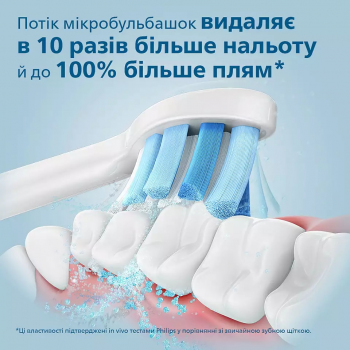 Набір електричних щіток Philips Sonicare Diamond Clean 9000 HX9914/69 Купить зубную электрощетку Набір електричних щіток Philips Sonicare Diamond Clean 9000 HX9914/69 | Фото 12