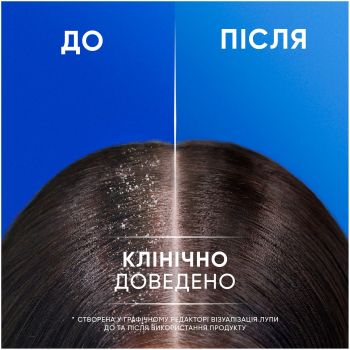 Шампунь-кондиціонер Head & Shoulders 2-в-1 проти лупи яблучна свіжість 330мл (8700216304689) | Фото 2