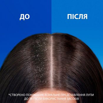 Шампунь та бальзам-ополіскувач проти лупи Head & Shoulders 2в1 Цитрусова свіжість 625мл (8700216158022) | Фото 6
