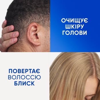 Шампунь Head & Shoulders проти лупи очищення та блиск 400мл (8700216658461) | Фото 6